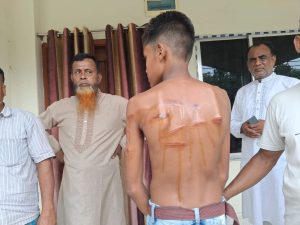 পাংশায় শিক্ষকের বেত্রাঘাতে আহত ছাত্র, হাসপাতালে ভর্তি